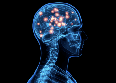 Focus article: The role of the ketogenic metabolic therapy for glioblastoma